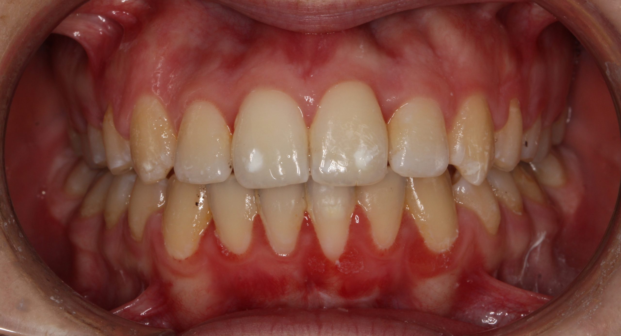 before-after